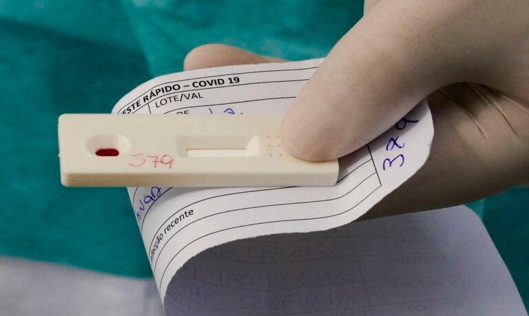Brasil ultrapassa 1 milhão de casos confirmados de Covid-19