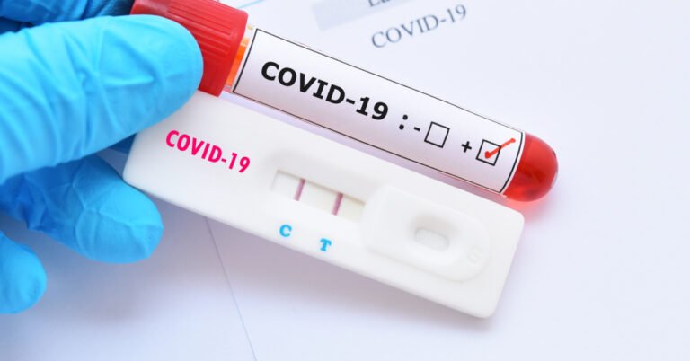 Saúde tera prioridade no teste de covid