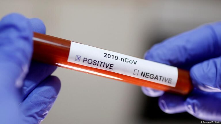 Ministério da Saúde confirma primeiro caso de reinfecção por covid-19 no país